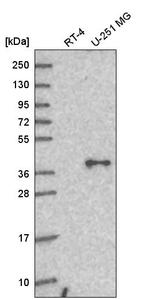 GNAQ Antibody in Western Blot (WB)