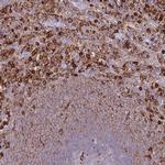 EFHD2 Antibody in Immunohistochemistry (IHC)