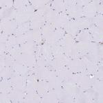 EFHD2 Antibody in Immunohistochemistry (IHC)