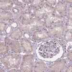 ZBTB24 Antibody in Immunohistochemistry (IHC)