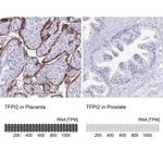 TFPI2 Antibody in Immunohistochemistry (IHC)