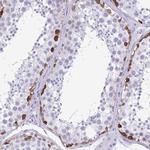 TSPY10 Antibody in Immunohistochemistry (IHC)