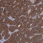 IDH3B Antibody in Immunohistochemistry (IHC)