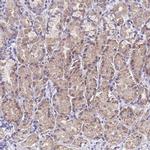 SPIRE2 Antibody in Immunohistochemistry (IHC)