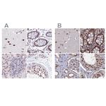 SF3A2 Antibody in Immunohistochemistry (IHC)