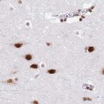 SF3A2 Antibody in Immunohistochemistry (IHC)