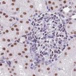 SF3A2 Antibody in Immunohistochemistry (IHC)