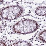 SF3A2 Antibody in Immunohistochemistry (IHC)