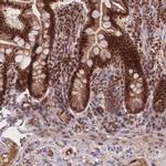 RAVER1 Antibody in Immunohistochemistry (IHC)