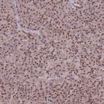 RAVER1 Antibody in Immunohistochemistry (IHC)