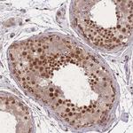 RAVER1 Antibody in Immunohistochemistry (IHC)