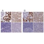 Adenylate Kinase 4 Antibody in Immunohistochemistry (IHC)