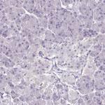 Adenylate Kinase 4 Antibody in Immunohistochemistry (IHC)