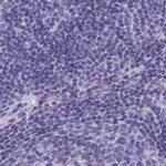 Adenylate Kinase 4 Antibody in Immunohistochemistry (IHC)