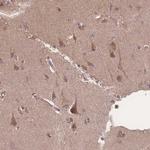 ATXN10 Antibody in Immunohistochemistry (IHC)