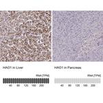 HAO1 Antibody