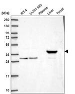 HAO1 Antibody in Western Blot (WB)