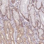 PUS10 Antibody in Immunohistochemistry (IHC)