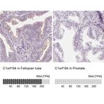 C1orf194 Antibody in Immunohistochemistry (IHC)