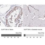 SUPT16H Antibody in Immunohistochemistry (IHC)