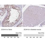 ZC3H14 Antibody in Immunohistochemistry (IHC)