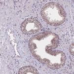 ZC3H14 Antibody in Immunohistochemistry (IHC)