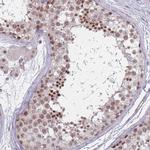 ZC3H14 Antibody in Immunohistochemistry (IHC)