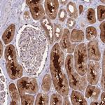 SALL1 Antibody in Immunohistochemistry (IHC)