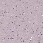 GAL Antibody in Immunohistochemistry (IHC)