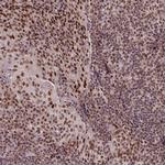 SRSF2 Antibody in Immunohistochemistry (IHC)