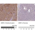 MRRF Antibody in Immunohistochemistry (IHC)