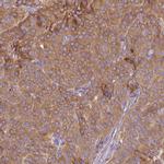 MRRF Antibody in Immunohistochemistry (IHC)