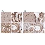 GLYR1 Antibody in Immunohistochemistry (IHC)