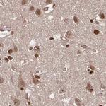 GLYR1 Antibody in Immunohistochemistry (IHC)