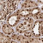 GLYR1 Antibody in Immunohistochemistry (IHC)