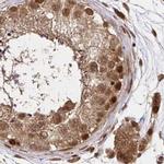 GLYR1 Antibody in Immunohistochemistry (IHC)