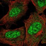 KCTD16 Antibody in Immunocytochemistry (ICC/IF)