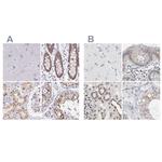 Nesprin 2 Antibody in Immunohistochemistry (IHC)