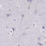 Nesprin 2 Antibody in Immunohistochemistry (IHC)