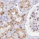 Nesprin 2 Antibody in Immunohistochemistry (IHC)