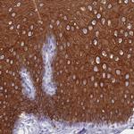 RAB2B Antibody in Immunohistochemistry (IHC)