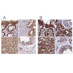 UQCRFS1 Antibody in Immunohistochemistry (IHC)