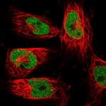 XPG Antibody in Immunocytochemistry (ICC/IF)