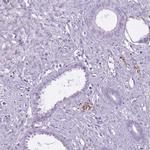 RFX4 Antibody in Immunohistochemistry (IHC)