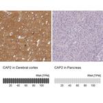 CAP2 Antibody in Immunohistochemistry (IHC)