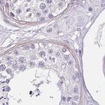 CAP2 Antibody in Immunohistochemistry (IHC)