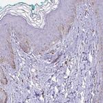 DNAI2 Antibody in Immunohistochemistry (IHC)