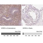 SFRP4 Antibody