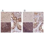 NSFL1C Antibody in Immunohistochemistry (IHC)