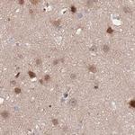 NSFL1C Antibody in Immunohistochemistry (IHC)